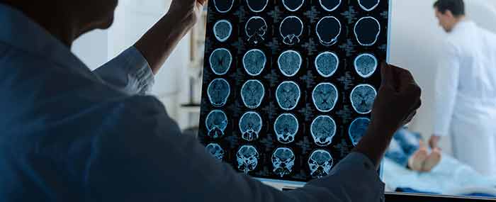 doctor looking at brain scans with mri in the background